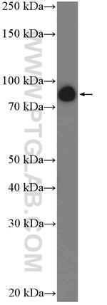 Gelsolin Antibody in Western Blot (WB)