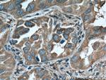 14-3-3 epsilon Antibody in Immunohistochemistry (Paraffin) (IHC (P))