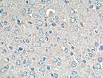 14-3-3 epsilon Antibody in Immunohistochemistry (Paraffin) (IHC (P))