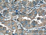 14-3-3 epsilon Antibody in Immunohistochemistry (Paraffin) (IHC (P))