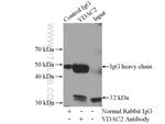 VDAC2 Antibody in Immunoprecipitation (IP)