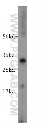 VDAC2 Antibody in Western Blot (WB)