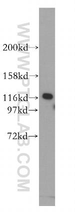 IPO4 Antibody in Western Blot (WB)