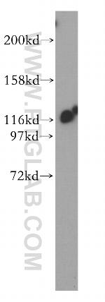 IPO4 Antibody in Western Blot (WB)