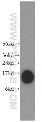 Profilin 1 Antibody in Western Blot (WB)