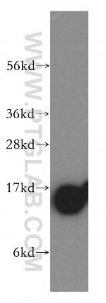 Profilin 1 Antibody in Western Blot (WB)