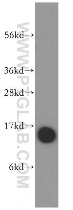 Profilin 1 Antibody in Western Blot (WB)