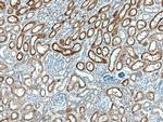 CYP4A11 Antibody in Immunohistochemistry (Paraffin) (IHC (P))