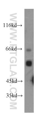 CYP4A11 Antibody in Western Blot (WB)