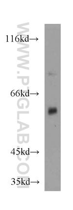 CYP4A11 Antibody in Western Blot (WB)