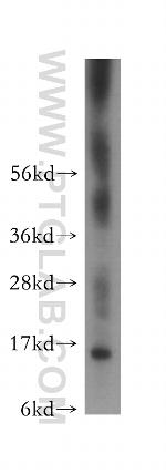 FKBP2 Antibody in Western Blot (WB)