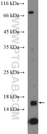 FKBP2 Antibody in Western Blot (WB)