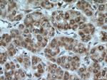 MRPL23 Antibody in Immunohistochemistry (Paraffin) (IHC (P))