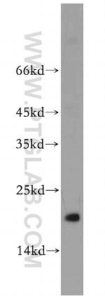 MRPL23 Antibody in Western Blot (WB)