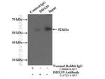 DDX39A Antibody in Immunoprecipitation (IP)