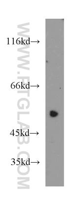 DDX39A Antibody in Western Blot (WB)
