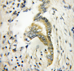 TWF1 Antibody in Immunohistochemistry (Paraffin) (IHC (P))