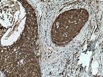 TWF1 Antibody in Immunohistochemistry (Paraffin) (IHC (P))