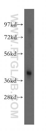 TWF1 Antibody in Western Blot (WB)