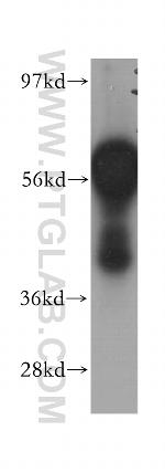 DCLRE1C Antibody in Western Blot (WB)