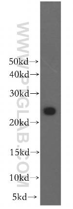 RAB2B Antibody in Western Blot (WB)