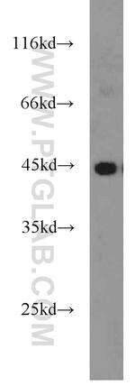 PANK1 Antibody in Western Blot (WB)