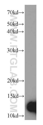 IgG light chain (Kappa) Antibody in Western Blot (WB)