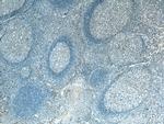 IgG light chain (Kappa) Antibody in Immunohistochemistry (Paraffin) (IHC (P))