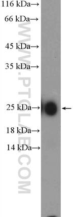 IgG light chain (Kappa) Antibody in Western Blot (WB)