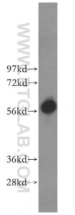 PRIM2 Antibody in Western Blot (WB)