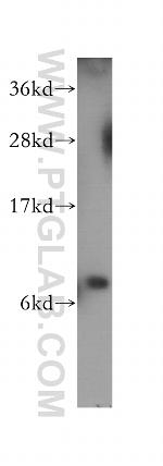 S100P Antibody in Western Blot (WB)