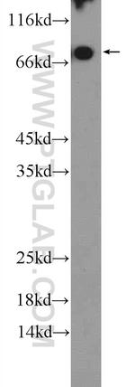 C4BPA Antibody in Western Blot (WB)