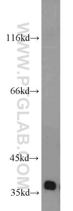 FBXO6 Antibody in Western Blot (WB)