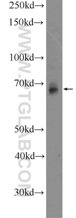 GBP2 Antibody in Western Blot (WB)