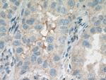 HSD17B6 Antibody in Immunohistochemistry (Paraffin) (IHC (P))