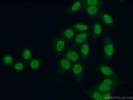 BRD3 Antibody in Immunocytochemistry (ICC/IF)