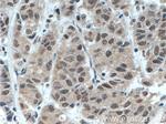 BRD3 Antibody in Immunohistochemistry (Paraffin) (IHC (P))