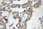 RAMP3 Antibody in Immunohistochemistry (Paraffin) (IHC (P))