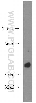 RAMP3 Antibody in Western Blot (WB)