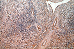 AGGF1 Antibody in Immunohistochemistry (Paraffin) (IHC (P))