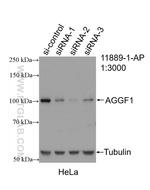 AGGF1 Antibody in Western Blot (WB)