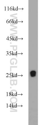 RGR Antibody in Western Blot (WB)