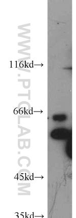 ATF2 Antibody in Western Blot (WB)