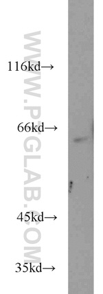 ATF2 Antibody in Western Blot (WB)