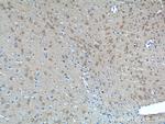 AP3M2 Antibody in Immunohistochemistry (Paraffin) (IHC (P))