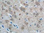 AP3M2 Antibody in Immunohistochemistry (Paraffin) (IHC (P))