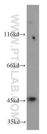 AP3M2 Antibody in Western Blot (WB)