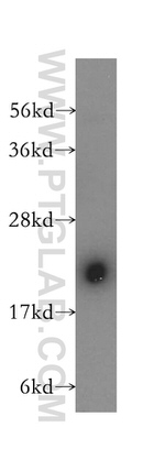 COMMD1 Antibody in Western Blot (WB)