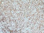 RAB5A Antibody in Immunohistochemistry (Paraffin) (IHC (P))