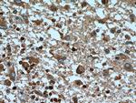 RAB5A Antibody in Immunohistochemistry (Paraffin) (IHC (P))